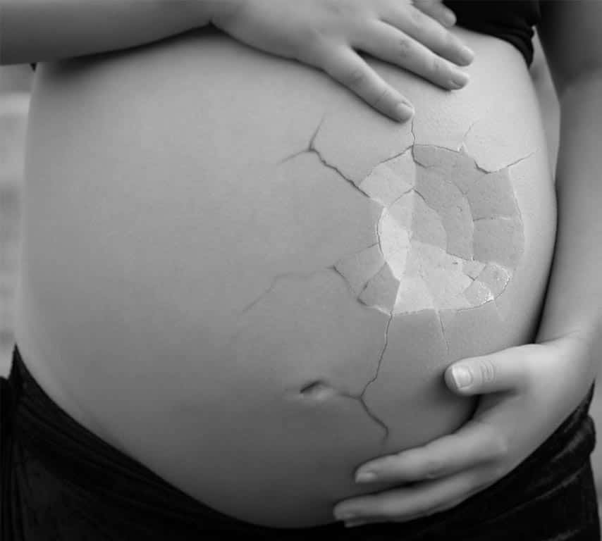 imagen de un estomago roto, haciendo alucion al embarazo y el aborto